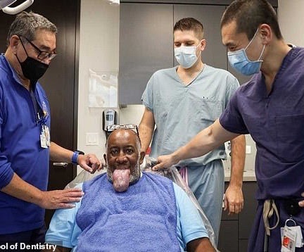 A person showing his bloated tongue